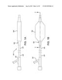 CONTROLLABLE INFLATION PROFILE BALLOON COVER APPARATUS AND METHODS diagram and image