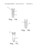 ORTHOPAEDIC SCREWS diagram and image