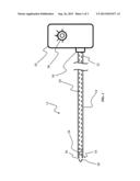 BLADDER WALL DRUG DELIVERY SYSTEM diagram and image