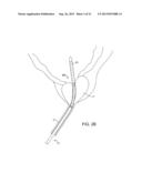 Minimally Invasive Devices for Multi-Fluid Tissue Ablation diagram and image