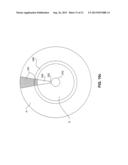 Minimally Invasive Devices for Multi-Fluid Tissue Ablation diagram and image