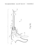 METHOD AND APPARATUS FOR PROGRAMMING MODULAR SURGICAL INSTRUMENT diagram and image