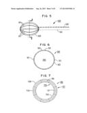 SYSTEM AND METHOD FOR PERFORMING ABLATION USING AN EXPANDABLE MEMBER diagram and image