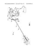 DE-TENSIONING MECHANISM FOR ARTICULATION DRIVE CABLES diagram and image