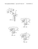 EXTERNAL FIXATOR STRUT diagram and image