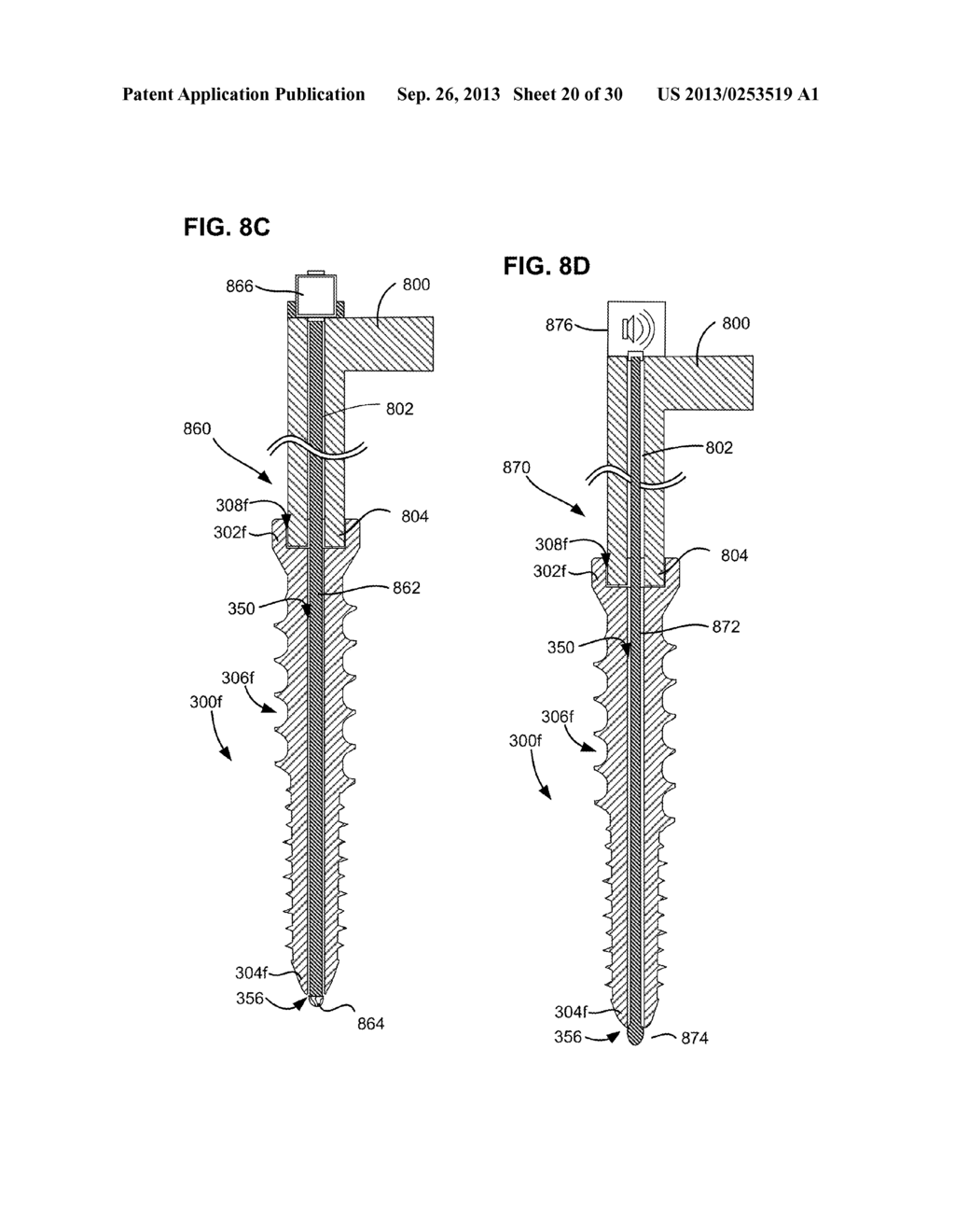 SYSTEM AND METHOD FOR CREATING A BORE AND IMPLANTING A BONE SCREW IN A     VERTEBRA - diagram, schematic, and image 21