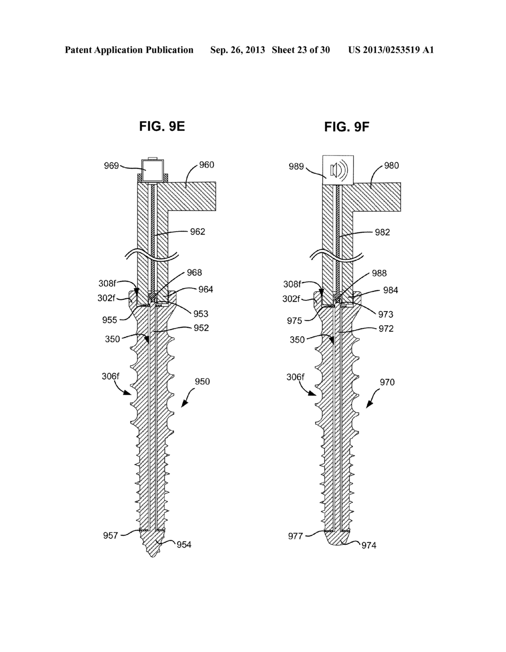 SYSTEM AND METHOD FOR CREATING A BORE AND IMPLANTING A BONE SCREW IN A     VERTEBRA - diagram, schematic, and image 24