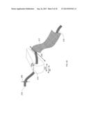 SUTURING DEVICE diagram and image