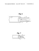 PHLEBECTOMY DEVICE AND SYSTEM diagram and image