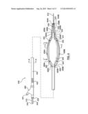 Percutaneous Methods and Apparatus for Creating Native Tissue Venous     Valves diagram and image