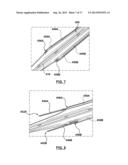 Percutaneous Methods and Apparatus for Creating Native Tissue Venous     Valves diagram and image