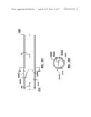 Percutaneous Methods and Apparatus for Creating Native Tissue Venous     Valves diagram and image