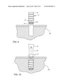 SUTURE ANCHOR HAVING A SUTURE ENGAGING STRUCTURE diagram and image