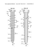 SYSTEM AND METHOD FOR SECURING AN IMPLANT TO A BONE CONTAINING BONE CEMENT diagram and image