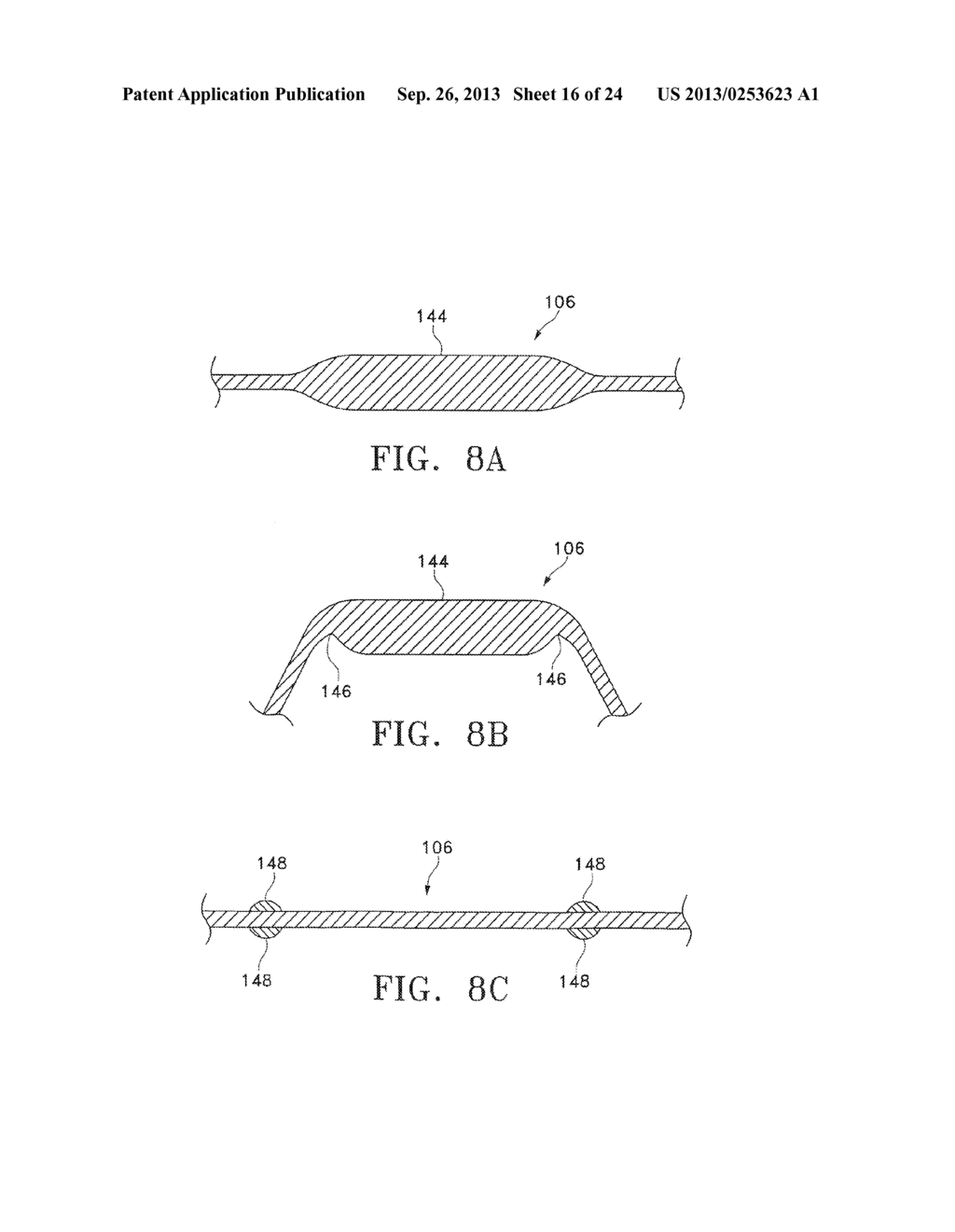 MODIFICATION OF AIRWAYS BY APPLICATION OF ENERGY - diagram, schematic, and image 17