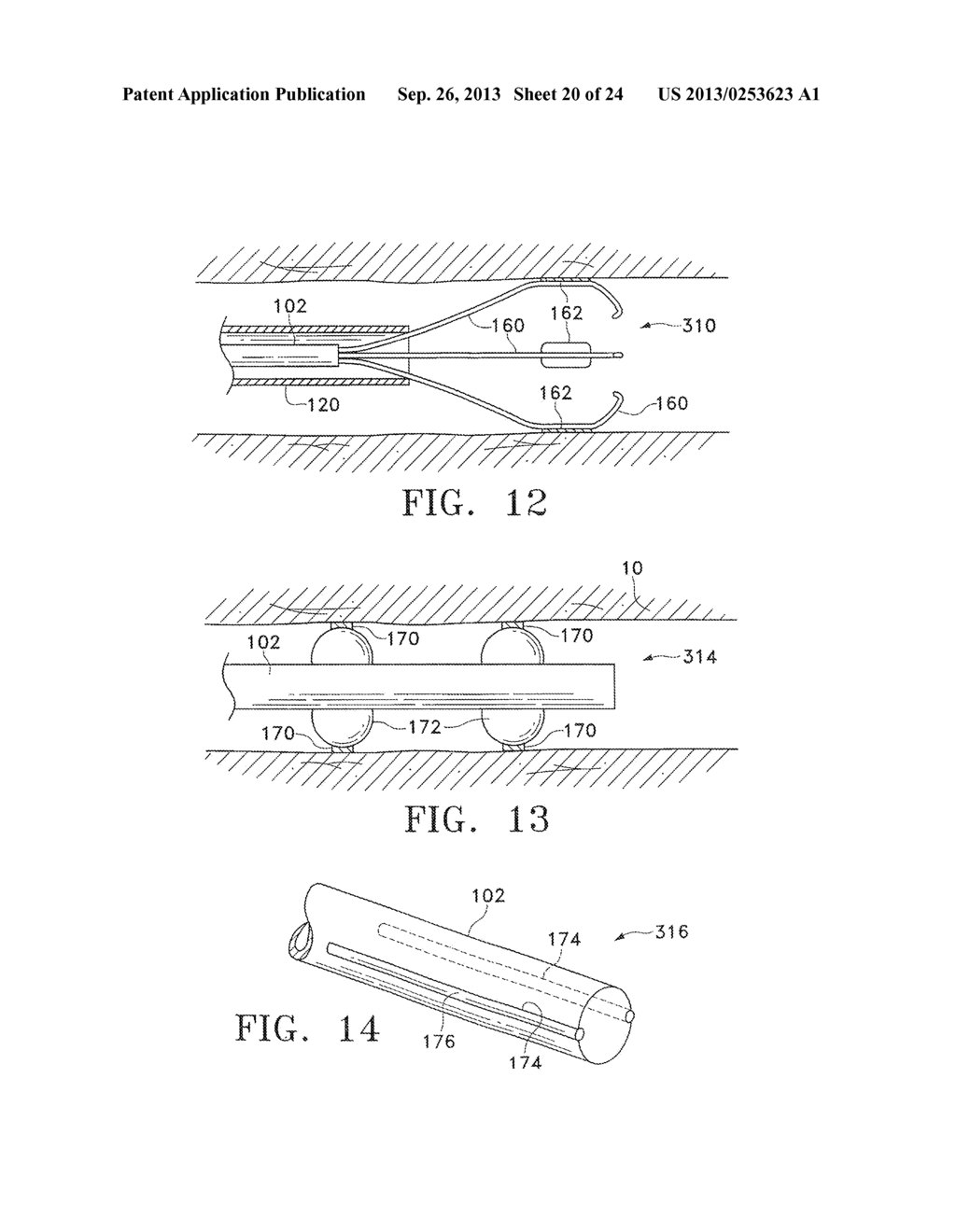 MODIFICATION OF AIRWAYS BY APPLICATION OF ENERGY - diagram, schematic, and image 21