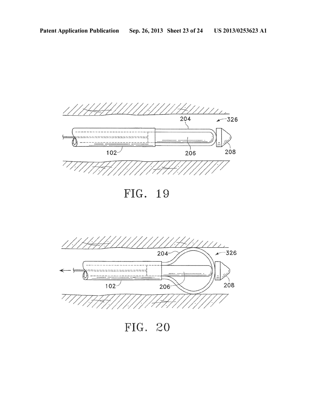 MODIFICATION OF AIRWAYS BY APPLICATION OF ENERGY - diagram, schematic, and image 24