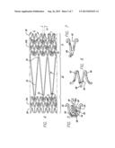 INTRAVASCULAR STENT AND METHOD OF USE diagram and image