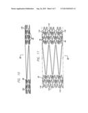 INTRAVASCULAR STENT AND METHOD OF USE diagram and image