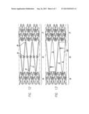 INTRAVASCULAR STENT AND METHOD OF USE diagram and image