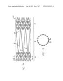 INTRAVASCULAR STENT AND METHOD OF USE diagram and image