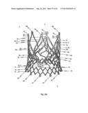 STENT FOR THE POSITIONING AND ANCHORING OF A VALVULAR PROSTHESIS IN AN     IMPLANTATION SITE IN THE HEART OF A PATIENT diagram and image