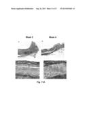 BIOHYBRID COMPOSITE SCAFFOLD diagram and image