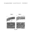 BIOHYBRID COMPOSITE SCAFFOLD diagram and image