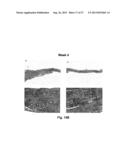 BIOHYBRID COMPOSITE SCAFFOLD diagram and image