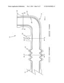 HOLLOW ARTICLE OF VARIABLE WALL STRUCTURE DENSITY diagram and image