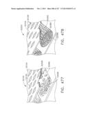 TISSUE THICKNESS COMPENSATOR COMPRISING CAPSULES DEFINING A LOW PRESSURE     ENVIRONMENT diagram and image
