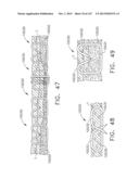 TISSUE THICKNESS COMPENSATOR HAVING IMPROVED VISIBILITY diagram and image