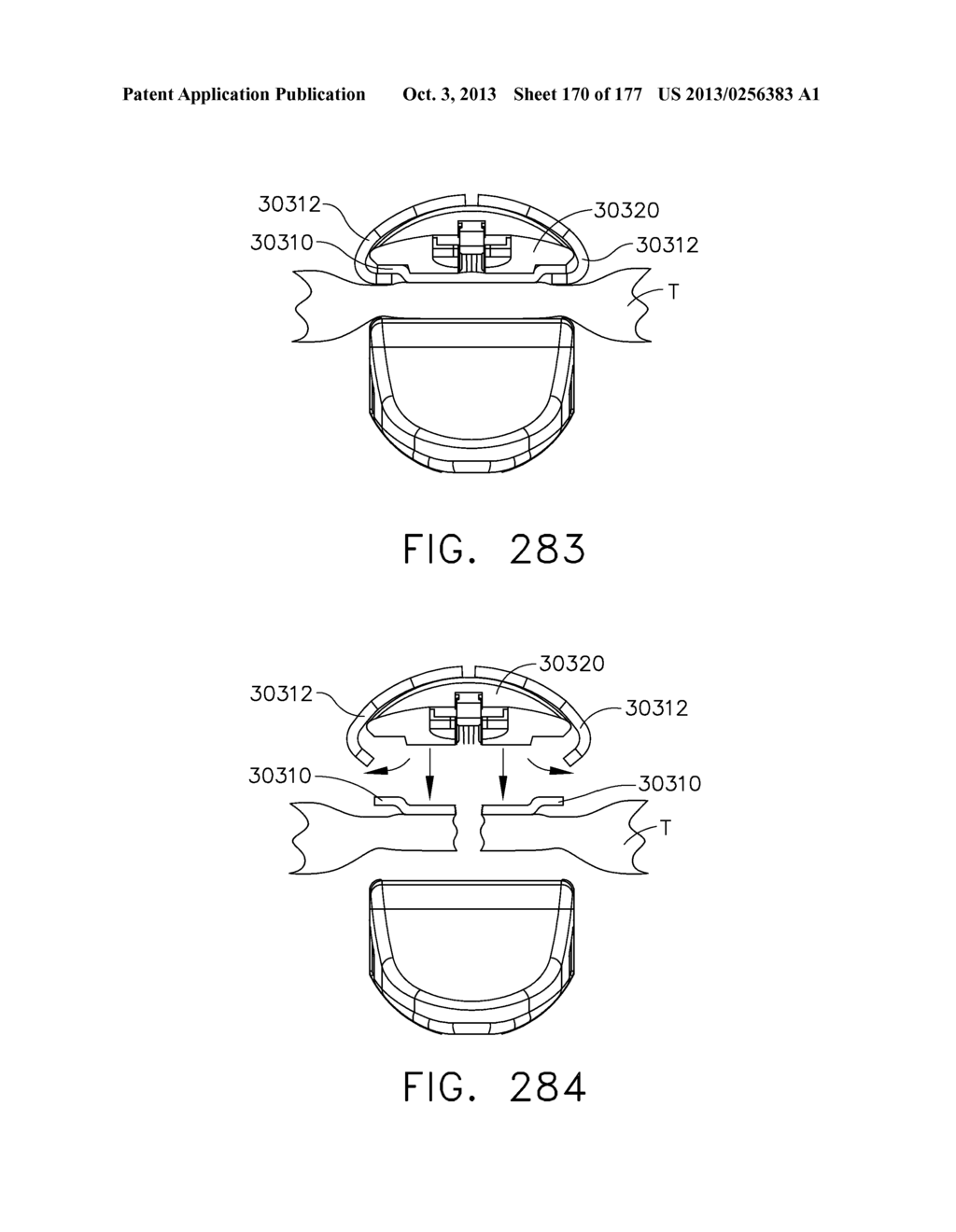 ANVIL LAYER ATTACHED TO A PROXIMAL END OF AN END EFFECTOR - diagram, schematic, and image 171