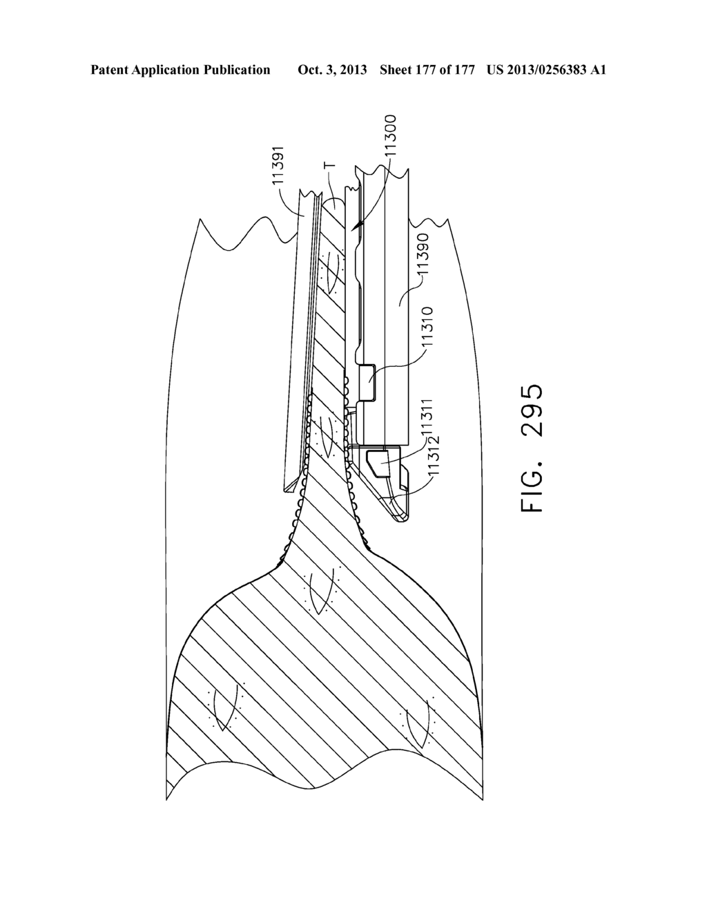 ANVIL LAYER ATTACHED TO A PROXIMAL END OF AN END EFFECTOR - diagram, schematic, and image 178