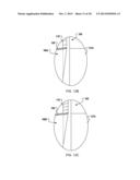 Blown Film Fastening diagram and image