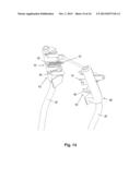 HEADREST FOR MOTOR VEHICLE SEATS diagram and image