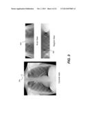 METHOD FOR ENHANCING RECONSTRUCTED 3-D TOMOSYNTHESIS VOLUME IMAGE diagram and image