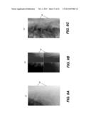 METHOD FOR ENHANCING RECONSTRUCTED 3-D TOMOSYNTHESIS VOLUME IMAGE diagram and image