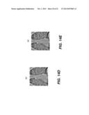 METHOD FOR ENHANCING RECONSTRUCTED 3-D TOMOSYNTHESIS VOLUME IMAGE diagram and image