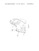 NAVIGATING ATTACHMENT FOR OPTICAL DEVICES IN MEDICINE, AND METHOD diagram and image