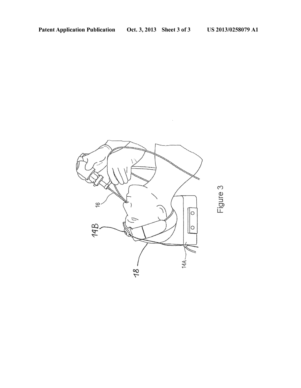 NAVIGATING ATTACHMENT FOR OPTICAL DEVICES IN MEDICINE, AND METHOD - diagram, schematic, and image 04