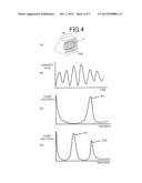 ULTRASONIC DIAGNOSTIC APPARATUS AND IMAGE PROCESSING METHOD diagram and image