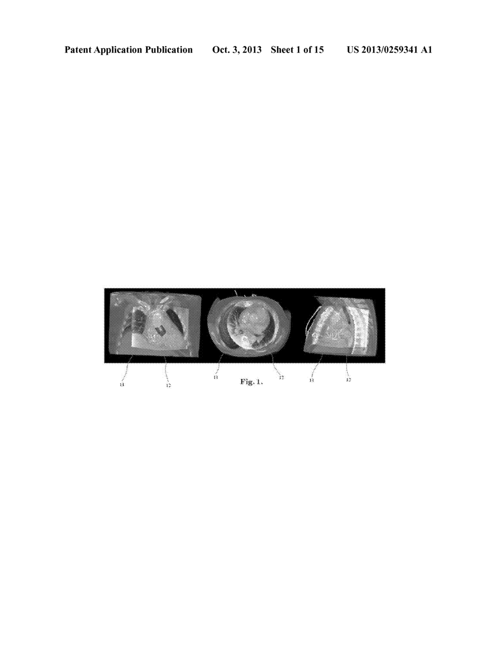 IMAGE FUSION FOR INTERVENTIONAL GUIDANCE - diagram, schematic, and image 02