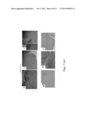 COMPOSITIONS AND METHODS FOR DIAGNOSING AND TREATING AN INFLAMMATION diagram and image