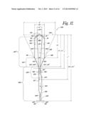 Varying transition zone manifold diagram and image