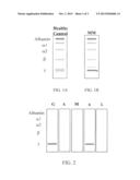 METHODS AND MATERIALS FOR MONITORING MYELOMA USING QUANTITATIVE MASS     SPECTROMETRY diagram and image