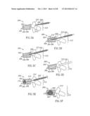 Methods, Materials and Apparatus for Treating Bone and Other Tissue diagram and image