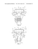 Methods and Devices for Tissue Retraction diagram and image