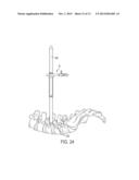 Methods and Devices for Tissue Retraction diagram and image