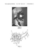 Methods and Devices for Tissue Retraction diagram and image